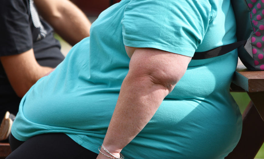 Pessoa obesa em referÃªncia ao debate sobre aumento da obesidade.