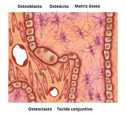 El tejido óseo tiene tres tipos de células: osteocitos, osteoblastos y osteoclastos.