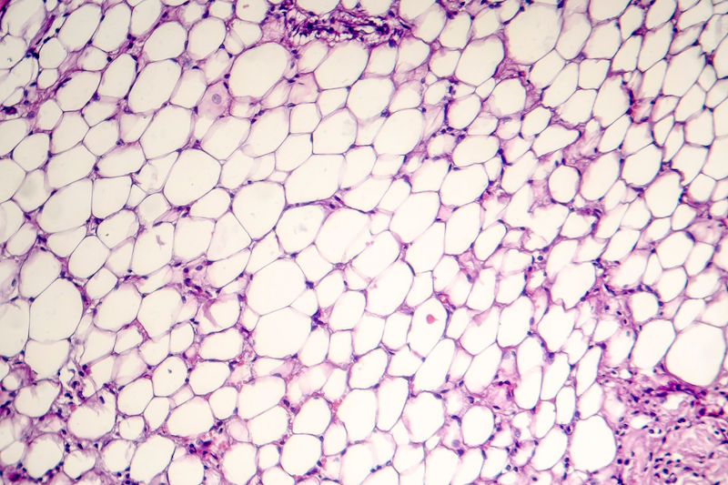 El tejido adiposo está formado por células capaces de almacenar grasa.