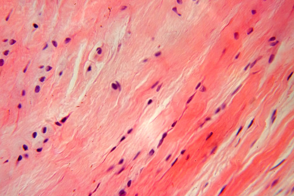 O tecido conjuntivo propriamente dito pode ser classificado em tecido conjuntivo frouxo e tecido conjuntivo denso.