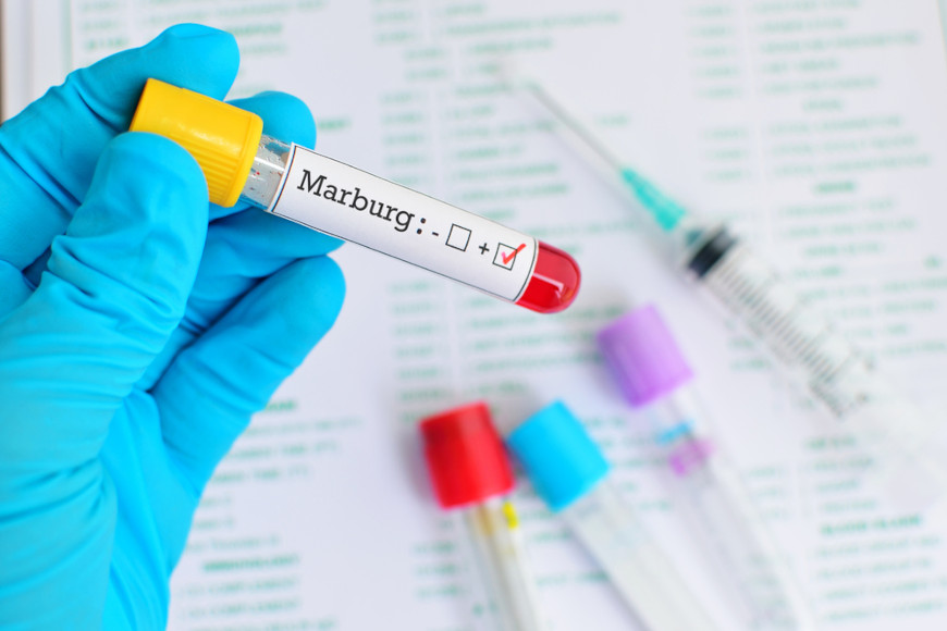 O vírus de Marburg é da mesma família do Ebola. Ele provoca uma doença grave e, muitas vezes, fatal.