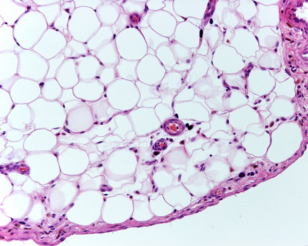 AdipÃ³citos, cÃ©lulas de gordura que formam o tecido adiposo, presente na hipoderme, vistos em microscÃ³pio.