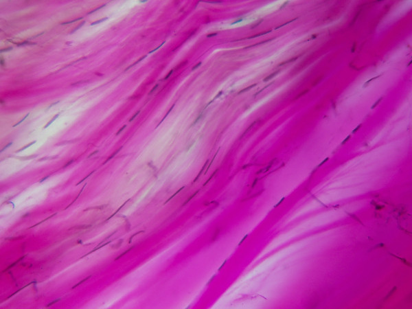 Imagem histológica de um tecido conjuntivo humano, um dos tecidos estudados pela Histologia.