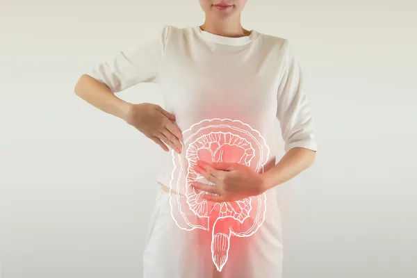 Síndrome do intestino irritável (SII)