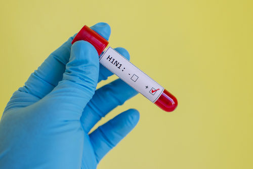 A gripe H1N1 é grave, por isso, é fundamental a prevenção contra essa doença