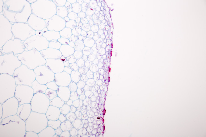 Las células del colénquima pueden formar cordones o cilindros justo debajo de la epidermis.