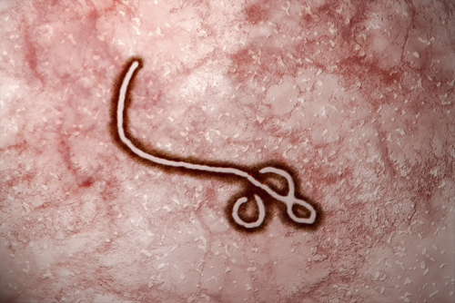 O ebola é um dos vírus mais fatais do mundo