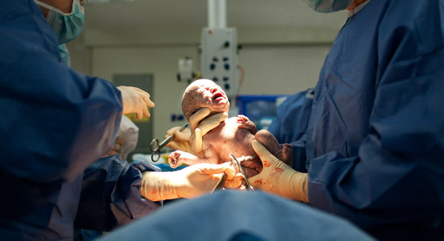 O parto é o momento no qual ocorre o nascimento do bebê.