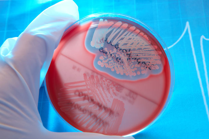 Um importante exemplo de seleção natural são as bactérias resistentes a antibióticos